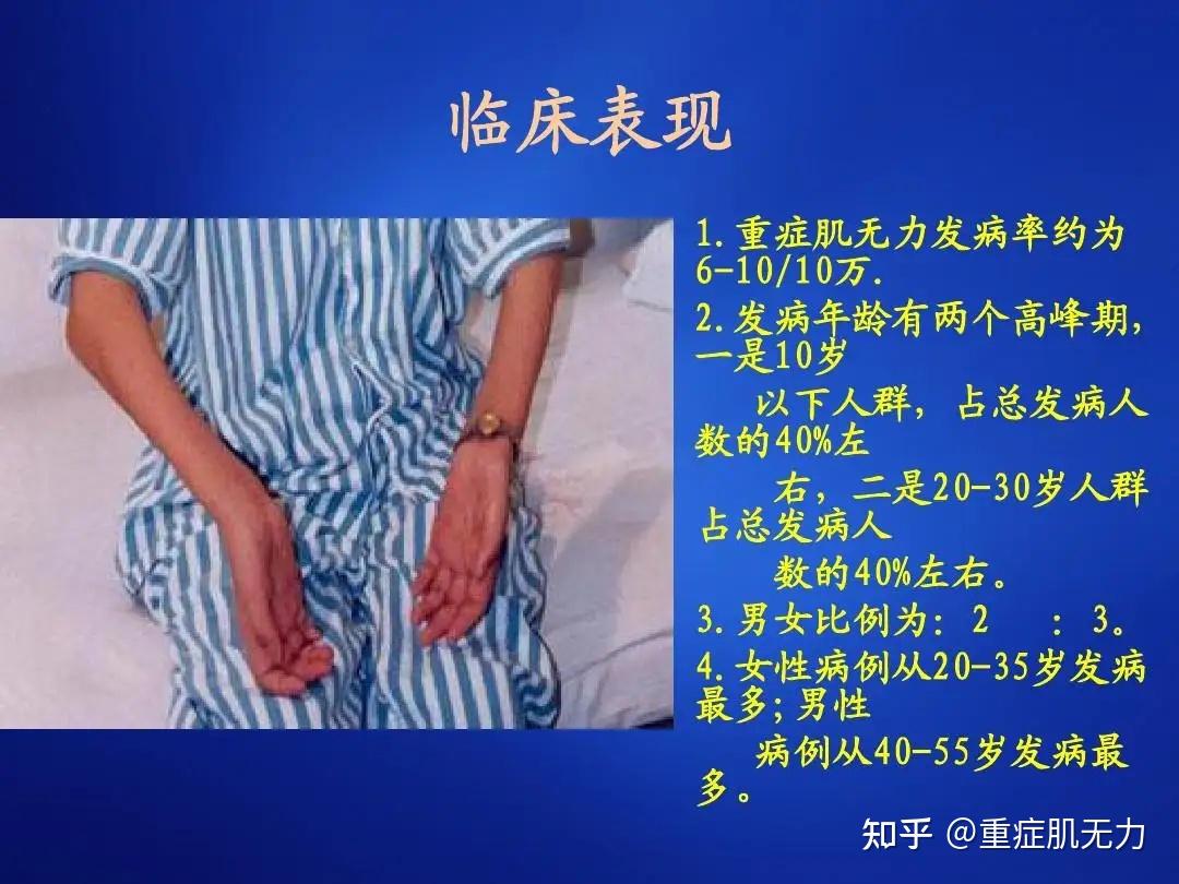 胸腺的改變也可導致眼肌型重症肌無力