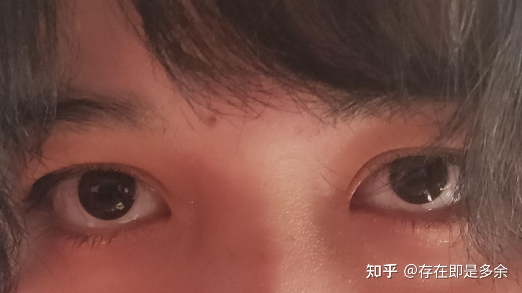 抑郁的人眼神都很空洞吗