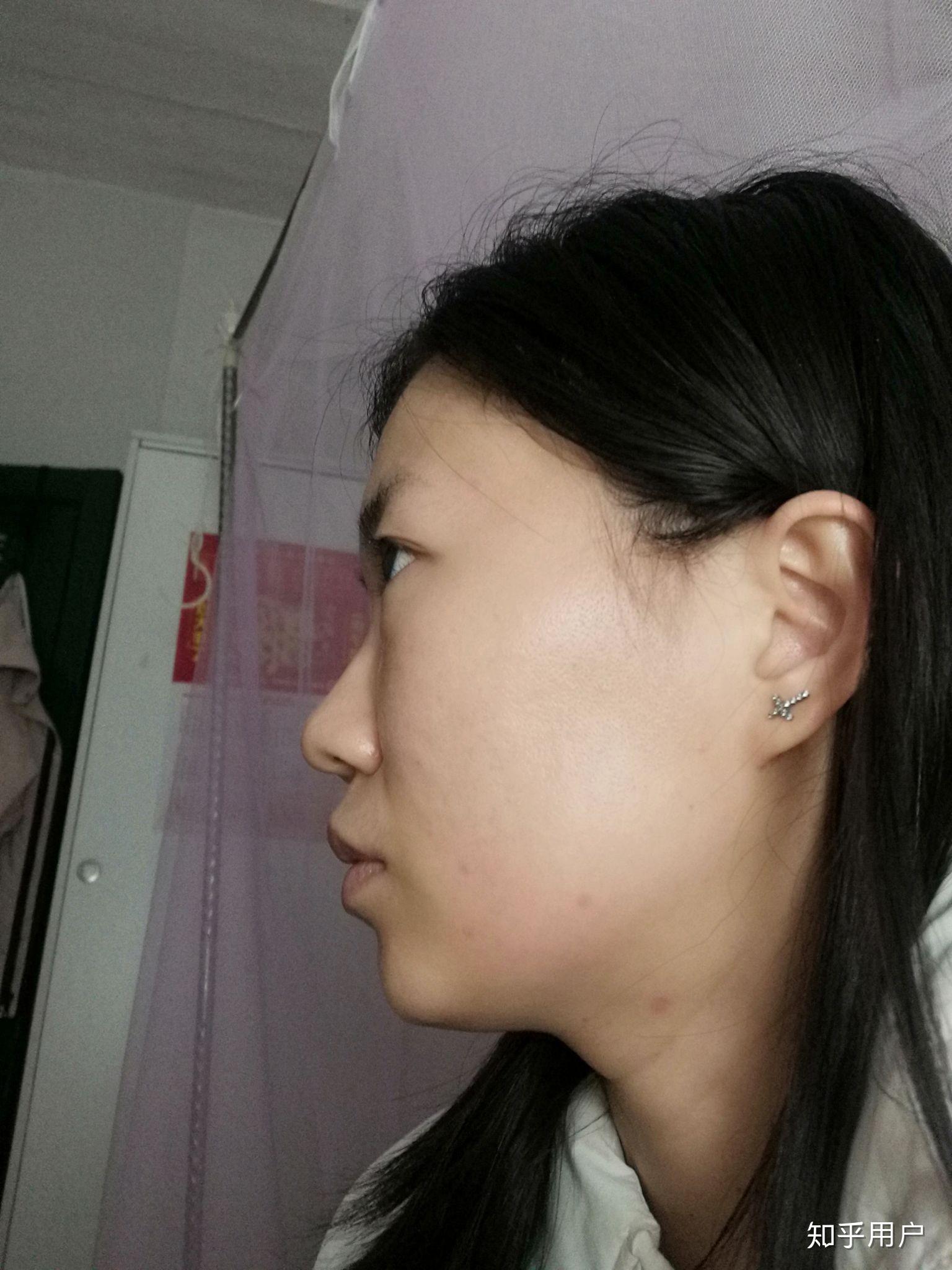 没有山根是种什么体验