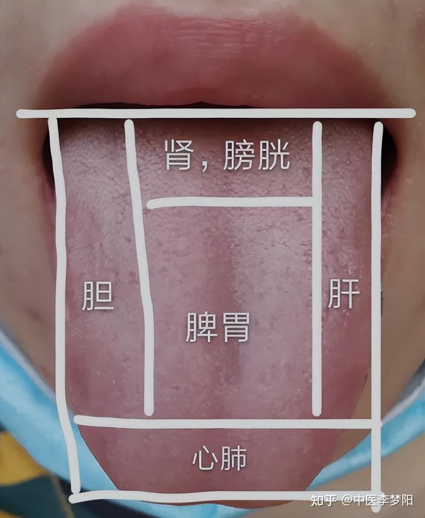 上不上火,一看舌头知道!教你认清5种火,对准火源,降火更有效 - 知乎