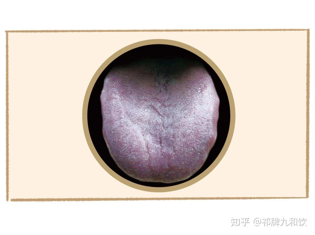 中医舌诊图谱来啦!看舌头知健康 通过舌象看看你是什么体质? - 知乎