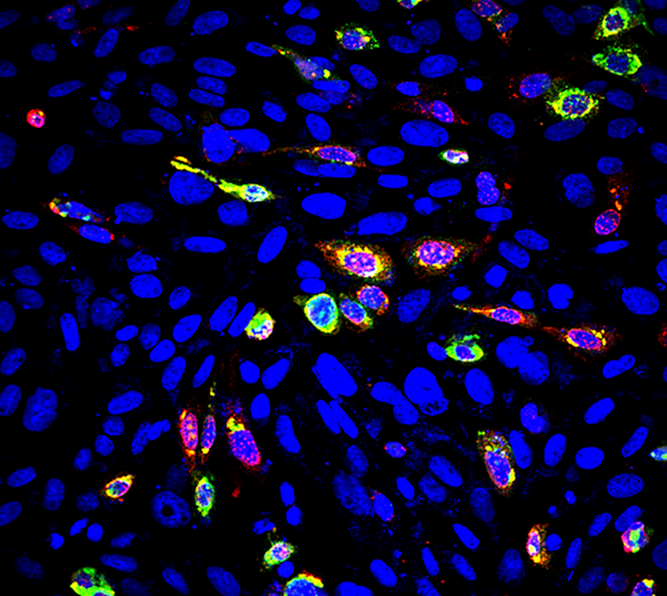 免疫荧光染色技术 - 知乎