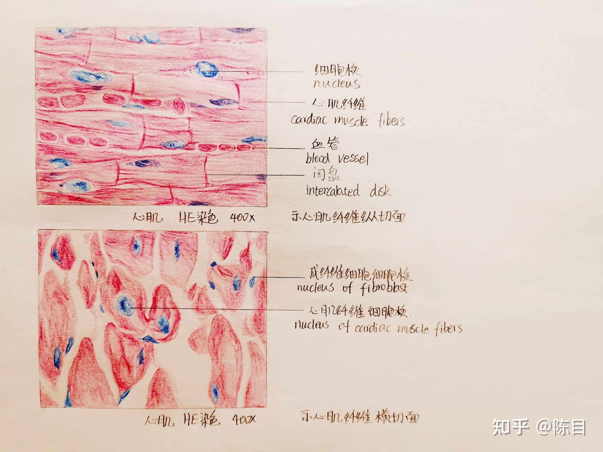 腰肌劳损和腰椎间盘突出有什么区别？ - 知乎