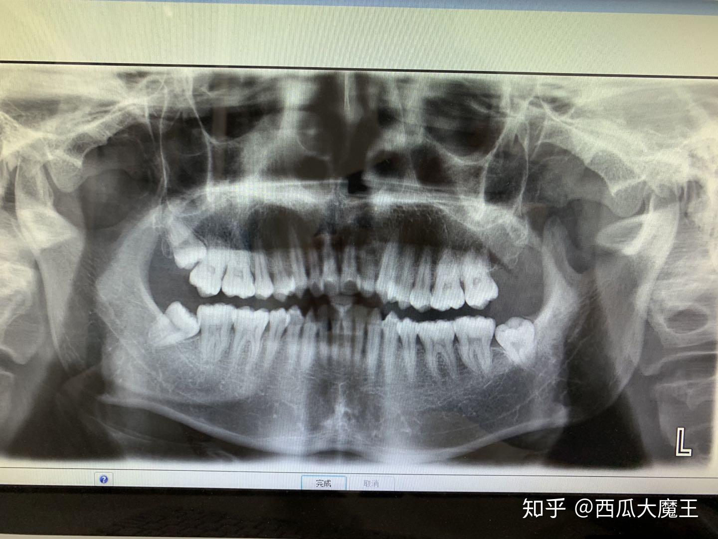 v2-5cd3cb681687c6c577ceef49525396ee_r.jpg
