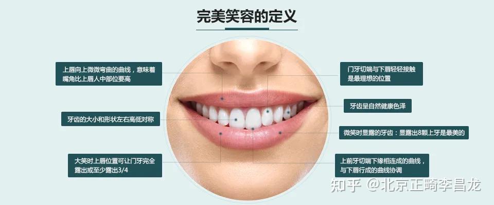 微笑新标准，笑线要好看，如何用正畸逆袭 - 知乎