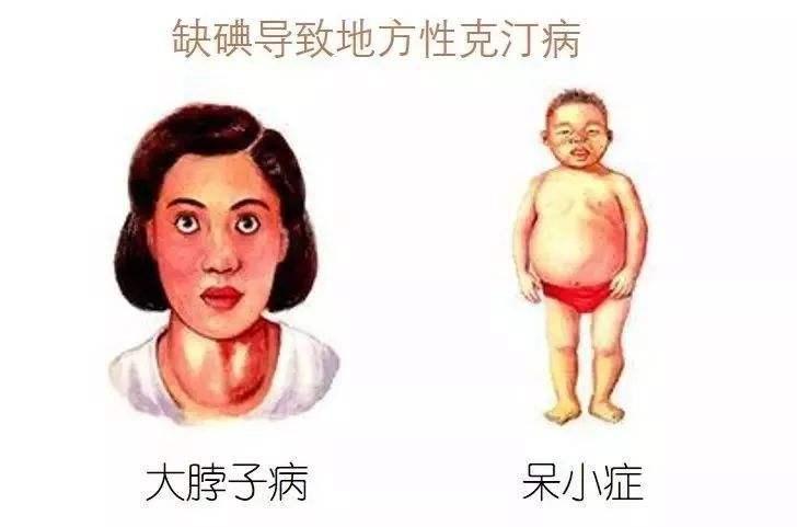 全国碘缺乏病宣传日科学补碘守护健康