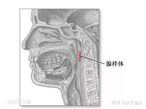 張口可以看到俗稱小舌頭的懸雍垂,而腺樣體則隱蔽在懸雍垂的後上方,也