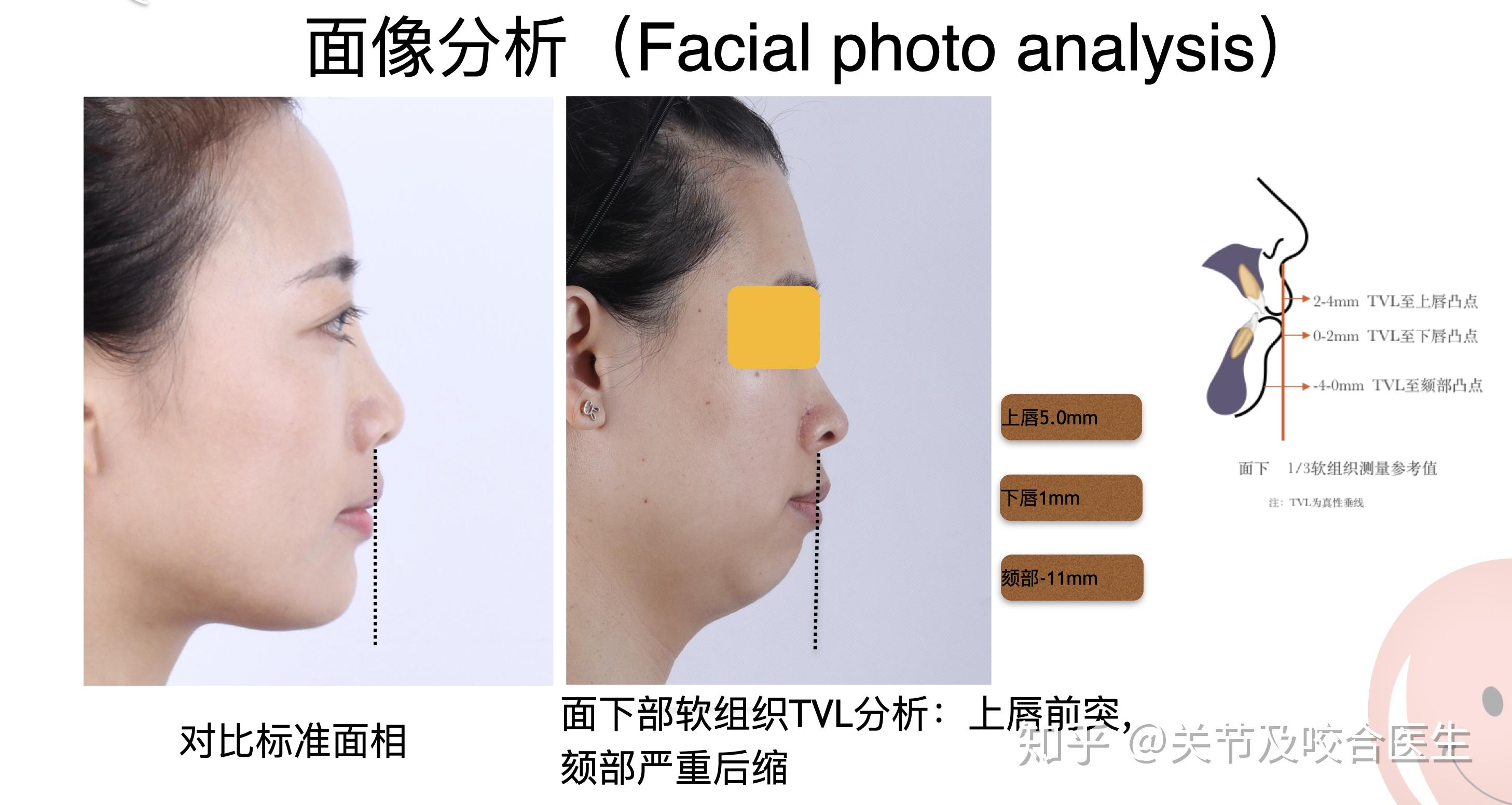 v2-5d50fed292a5b6b41648d692230a31f2_r.jpg