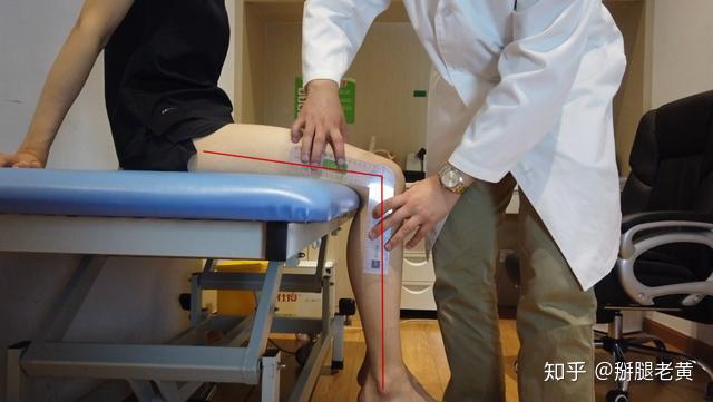 手把手教你测量关节角度 - 知乎