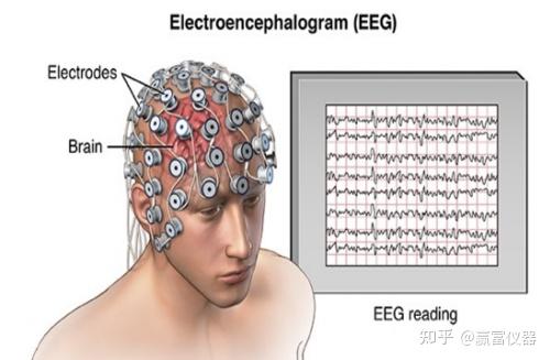 脑电（eeg），肌电（emg）和眼动追踪（eye Tracking），分别适用于哪些研究？ 知乎 