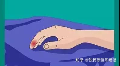 爱打篮球的你一定遇到过的痛手指戳伤