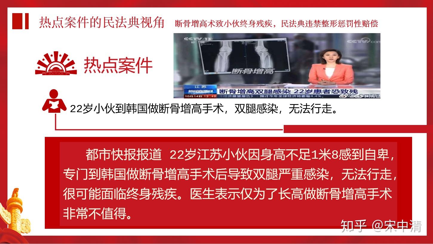 断骨增高手术严禁用于美容项目,适用民法典和消法中惩罚性赔偿责任.