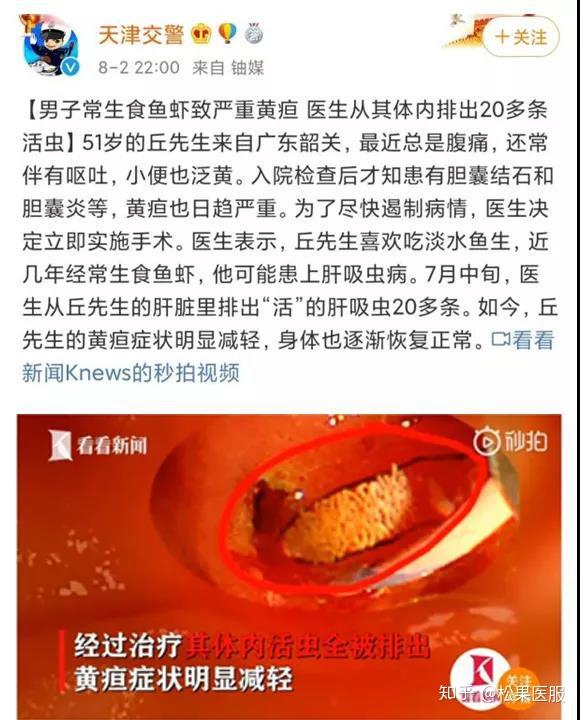 肝吸蟲病腹痛系列之肝膽篇