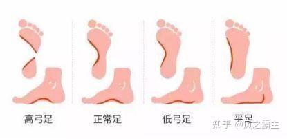 什么算高足弓 v2-5e9821aa61b862e4841b264a5dad4b22_b.jpg