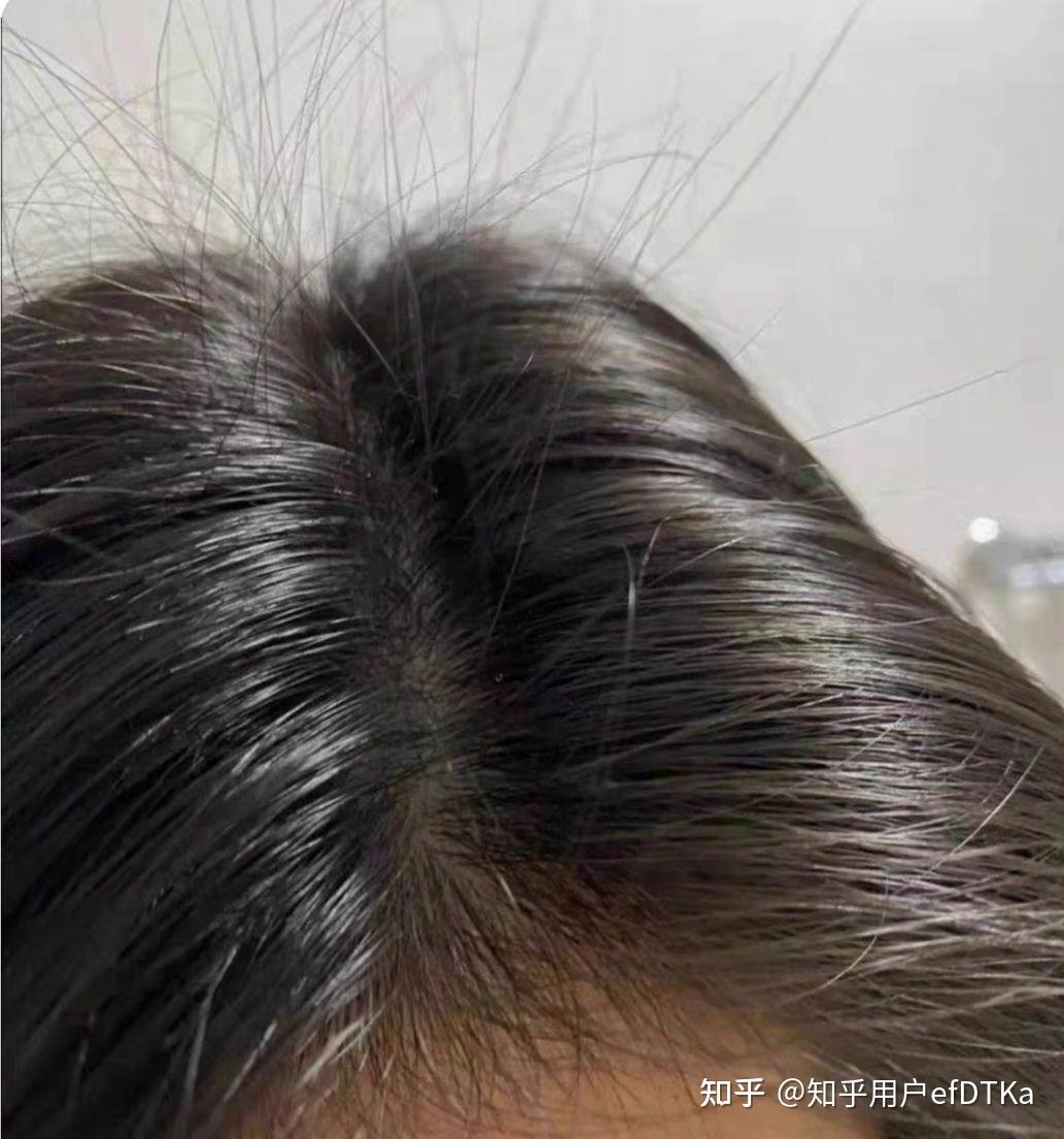 这是一个生发的过程。 - 知乎