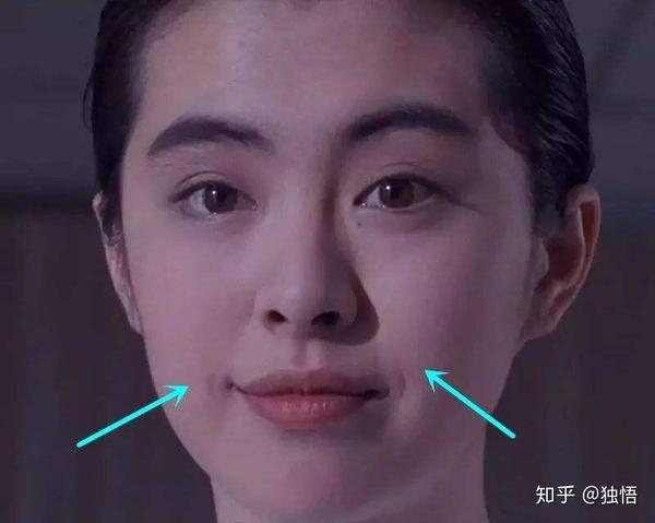 为什么长着长着嘴角出现了这个括号?