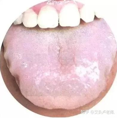 艾灸把这2处灸通了，全身湿气都排空！ - 知乎