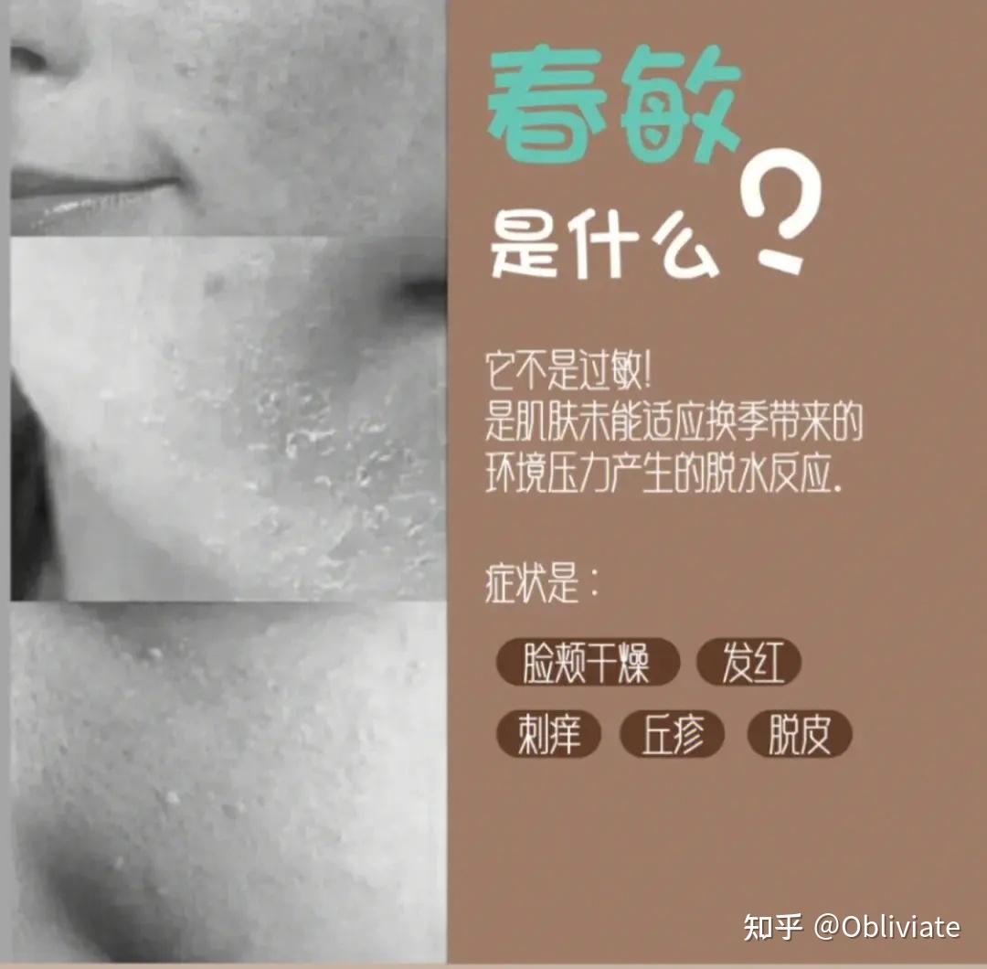 为啥一到春秋换季,皮肤就容易起皮爆皮,红敏刺痛? - 知乎