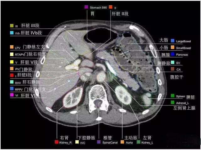 外科医生阅片能力:看完它,再也没有看不懂的腹部CT - 知乎