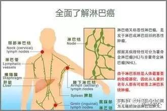 再不好好对淋巴 小心它疯狂报复你 知乎