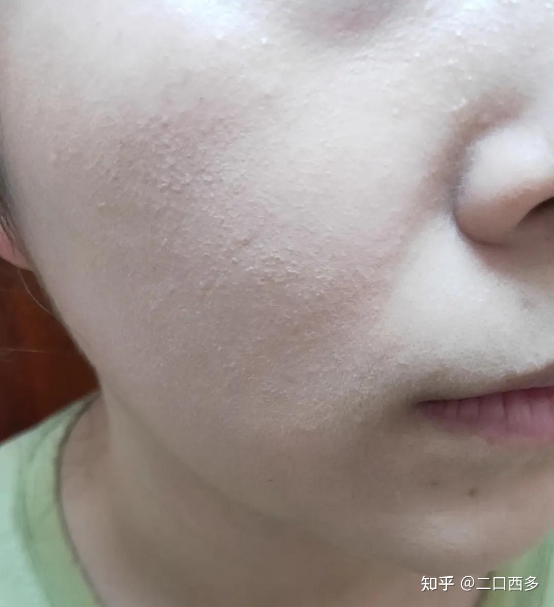 一直卡粉是脸的锅还是粉的锅