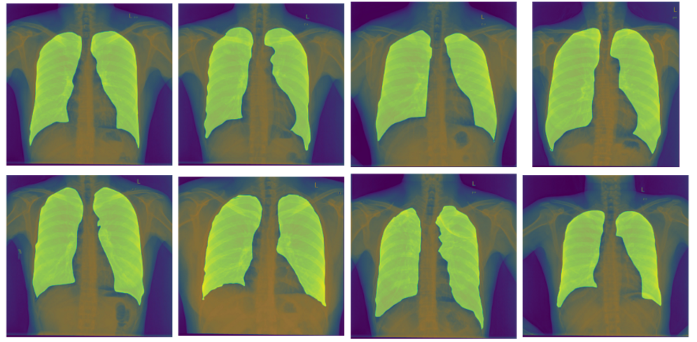 医学图像语义分割最佳方法的全面比较unet和unet