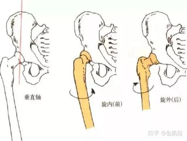 股骨内旋假胯宽图片