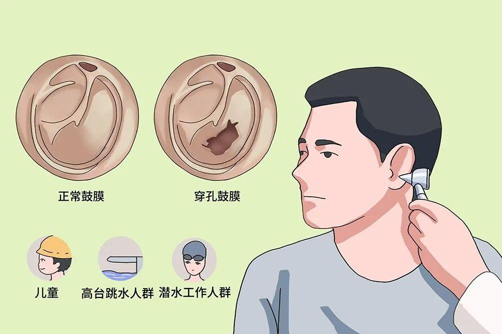 认识及预防传导性耳聋 - 知乎