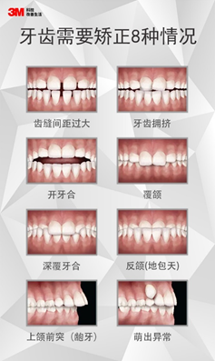 牙齿矫正不可不知的那些事儿 牙齿矫正方式有哪些 人社网