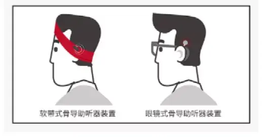 v2-605ae176f5cac98f1a713c9aea41aa6a_r.jpg