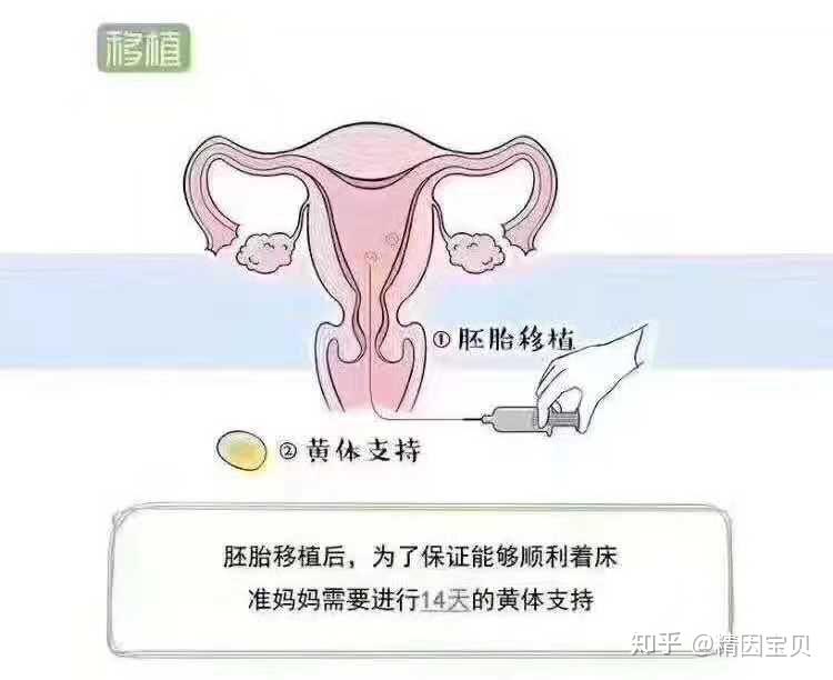 试管婴儿费用：透明化与透明度
