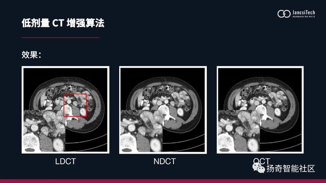 扬奇智能社区｜医学影像增强算法 - 知乎