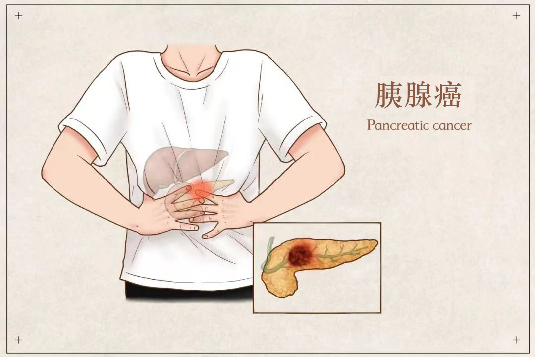胰腺位置图片 腹部图片