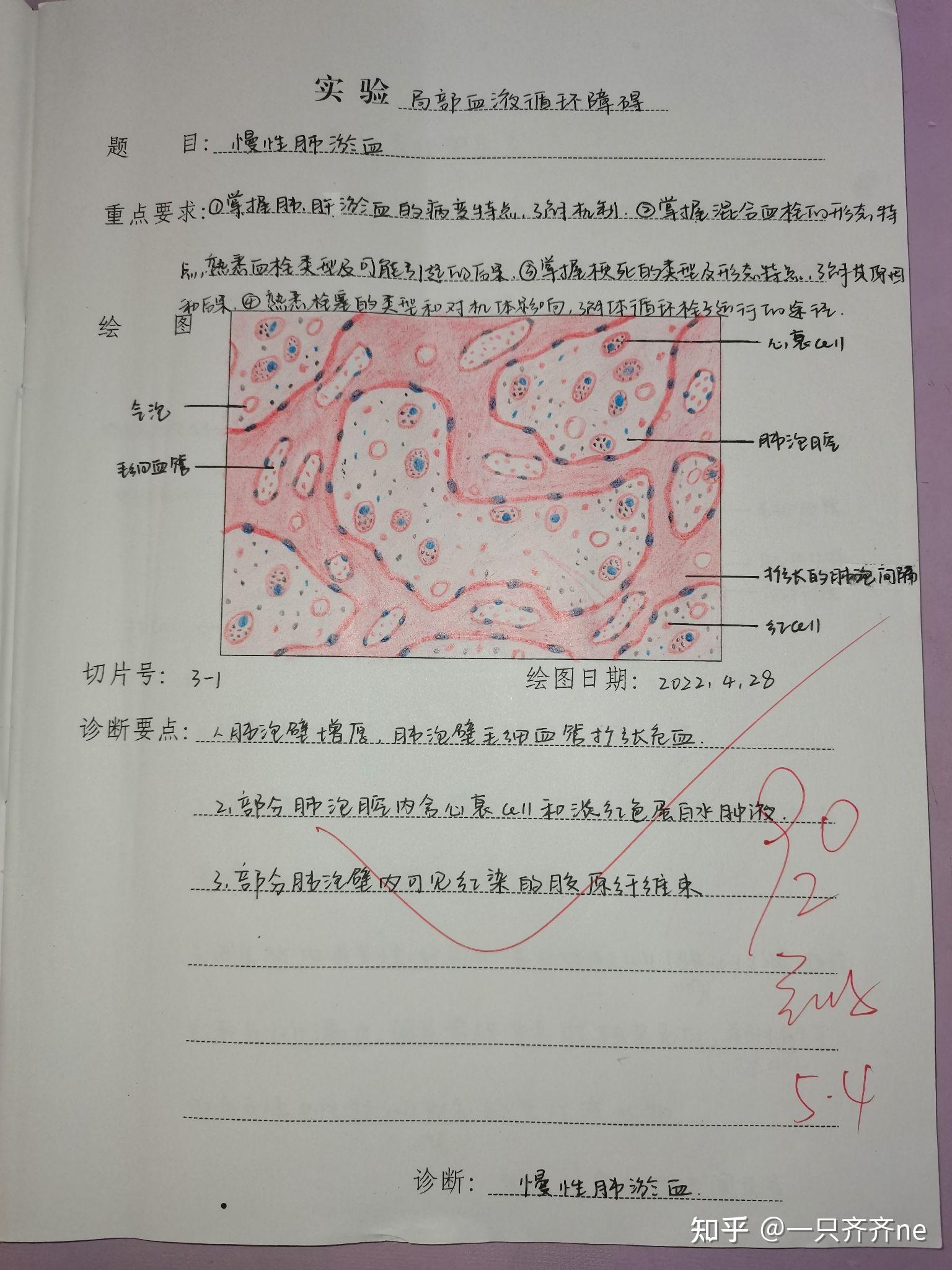 病理学红蓝铅笔绘图