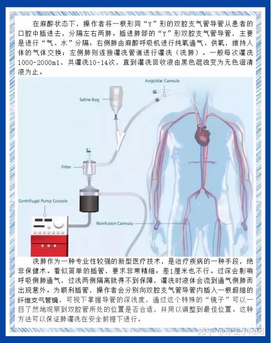 洗肺的孩子一天高達67例這兩個中成藥可以調理支原體肺炎避免重症建議