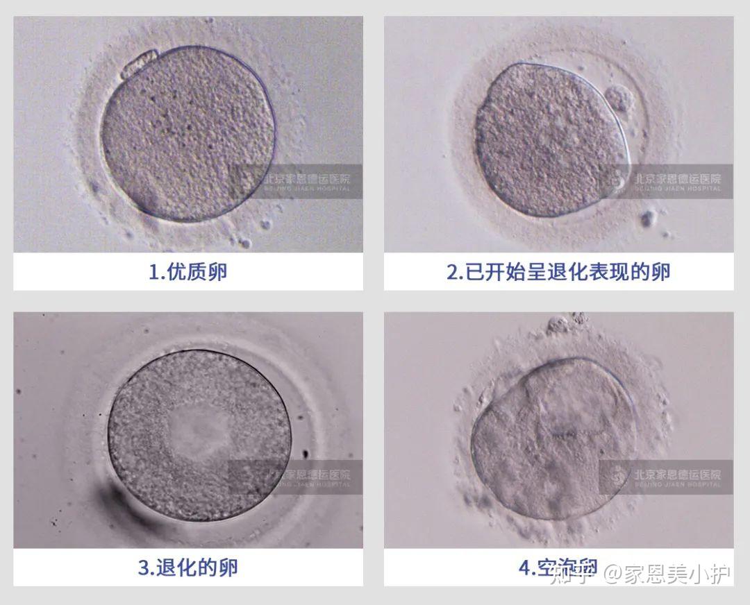 一招教你看懂囊胚评分! - 知乎