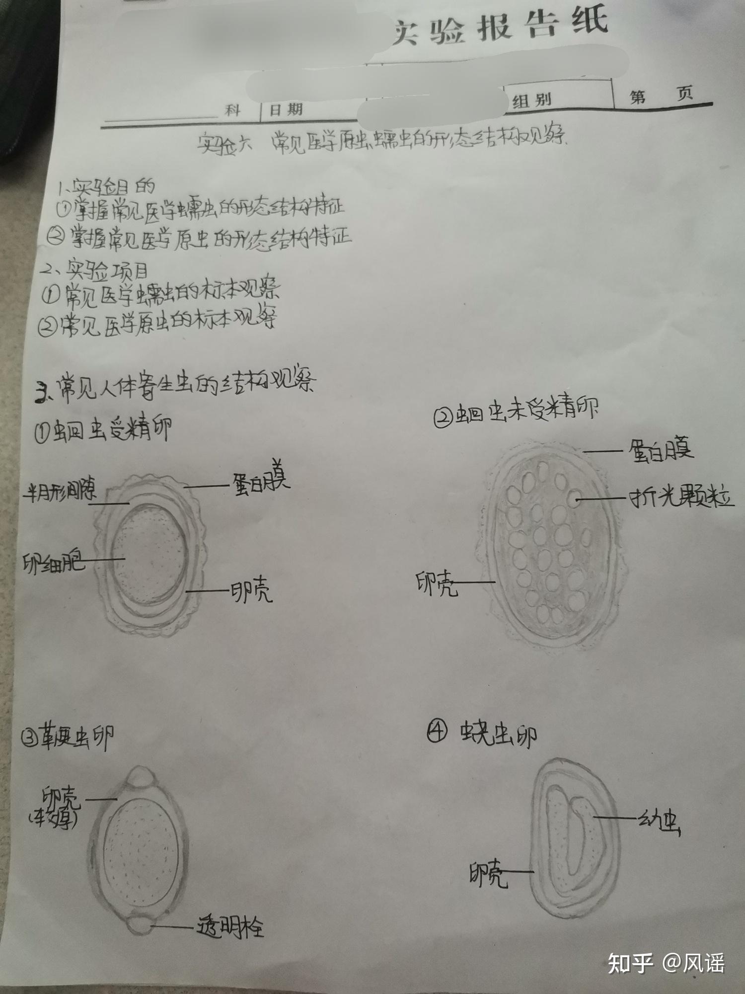 肠吸虫卵手绘图片图片