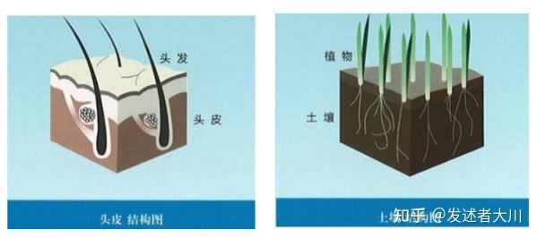 科普下，植发是什么原理？植发有哪些技术手段？如何去选择植发医院和植发医生？ - 知乎