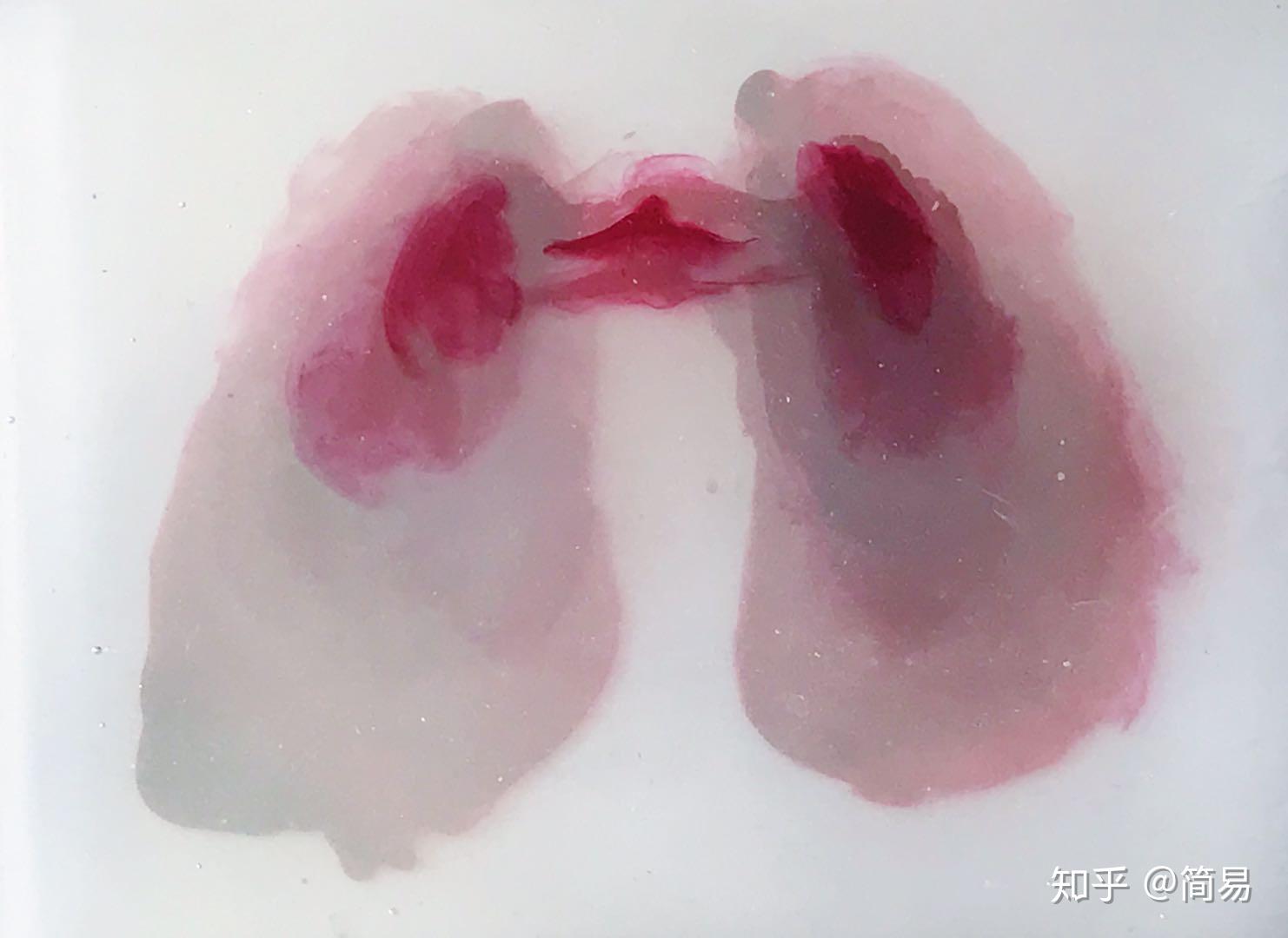 《红 肺 知乎