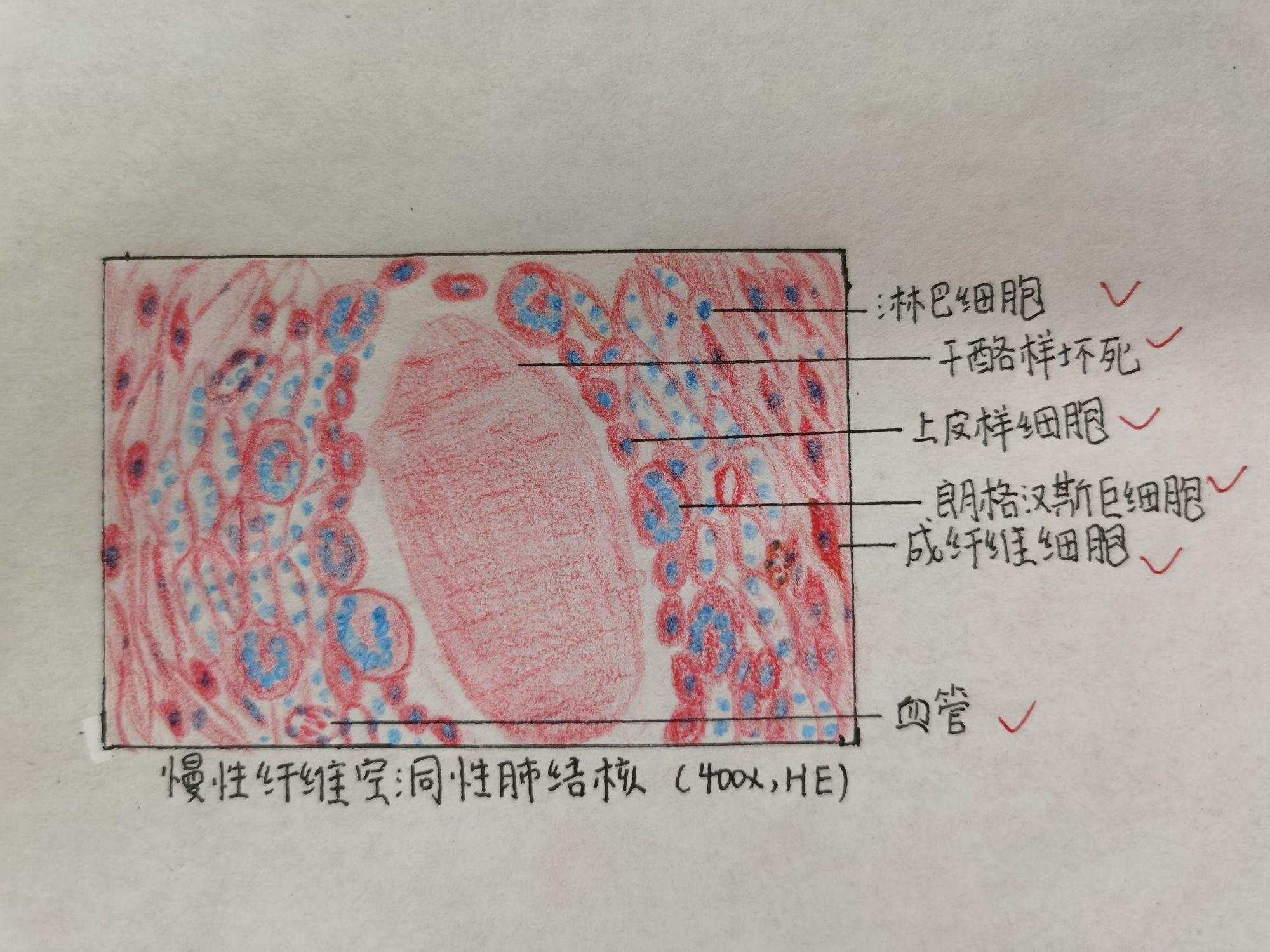 淋巴结光镜手绘图片