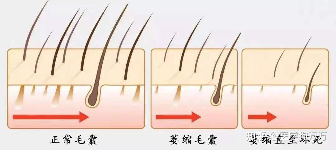 健康毛囊图片漩涡状图片