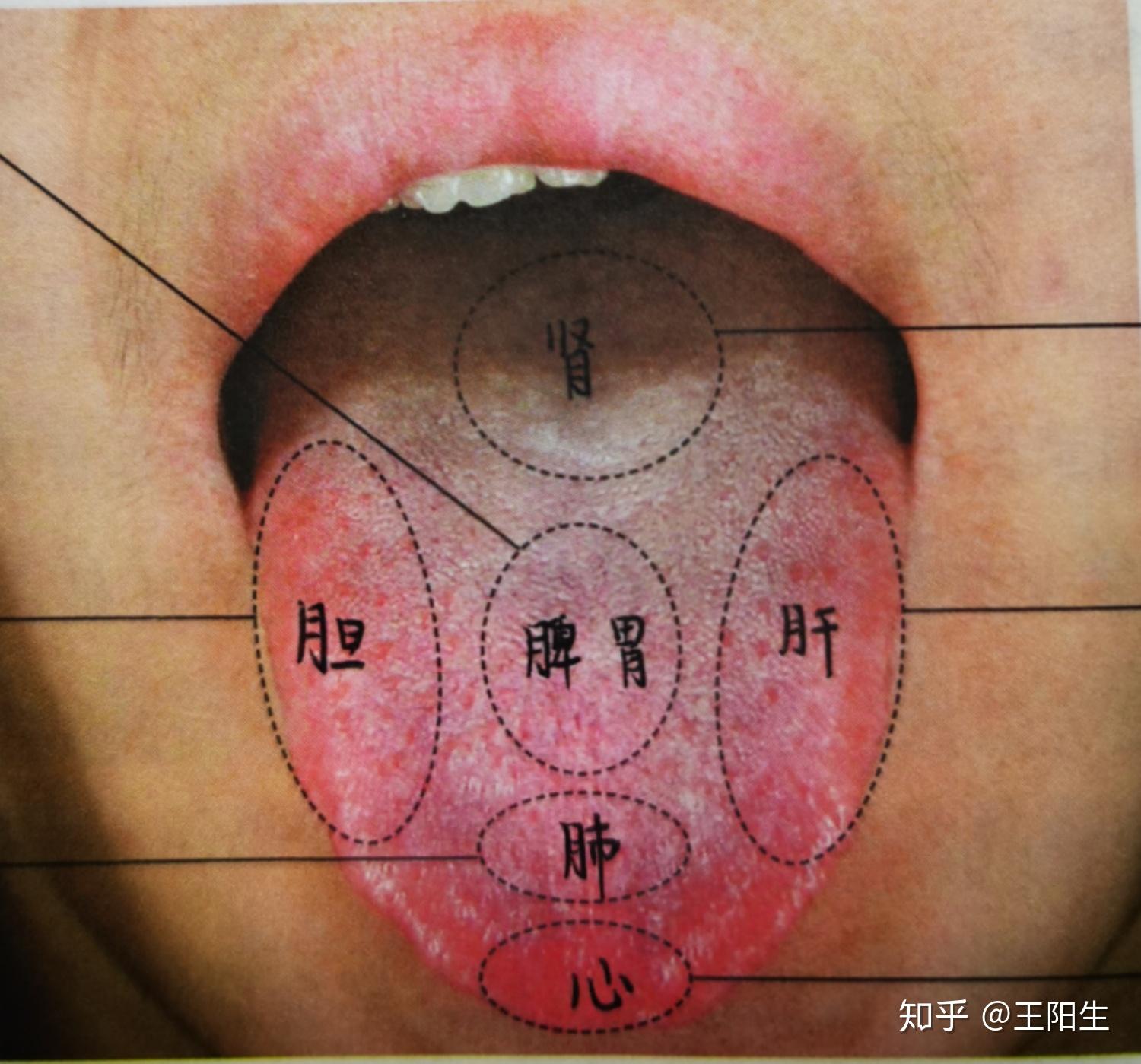 看舌头知病情图片图片