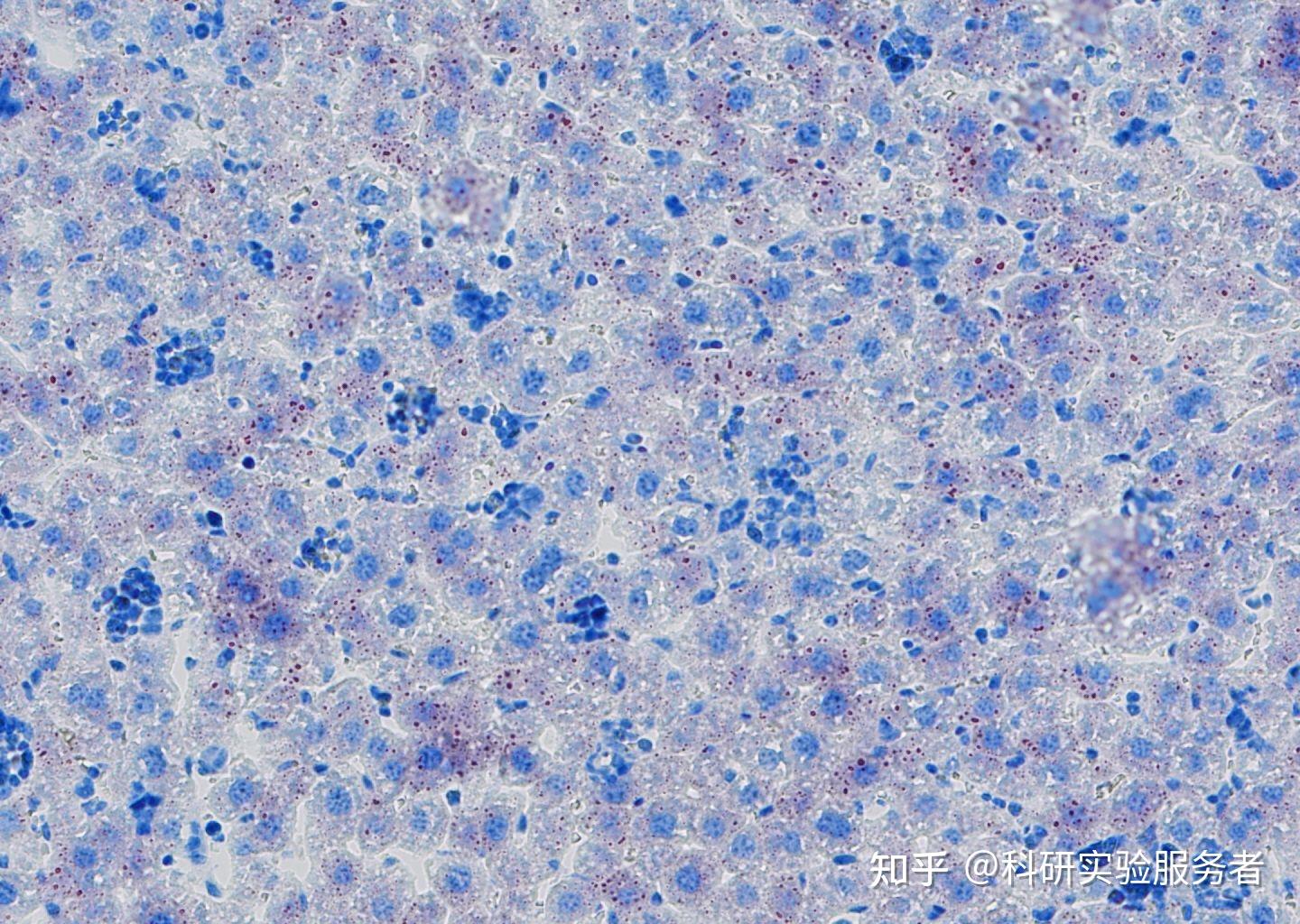 油红染色实验报告及结果展示上海郑核