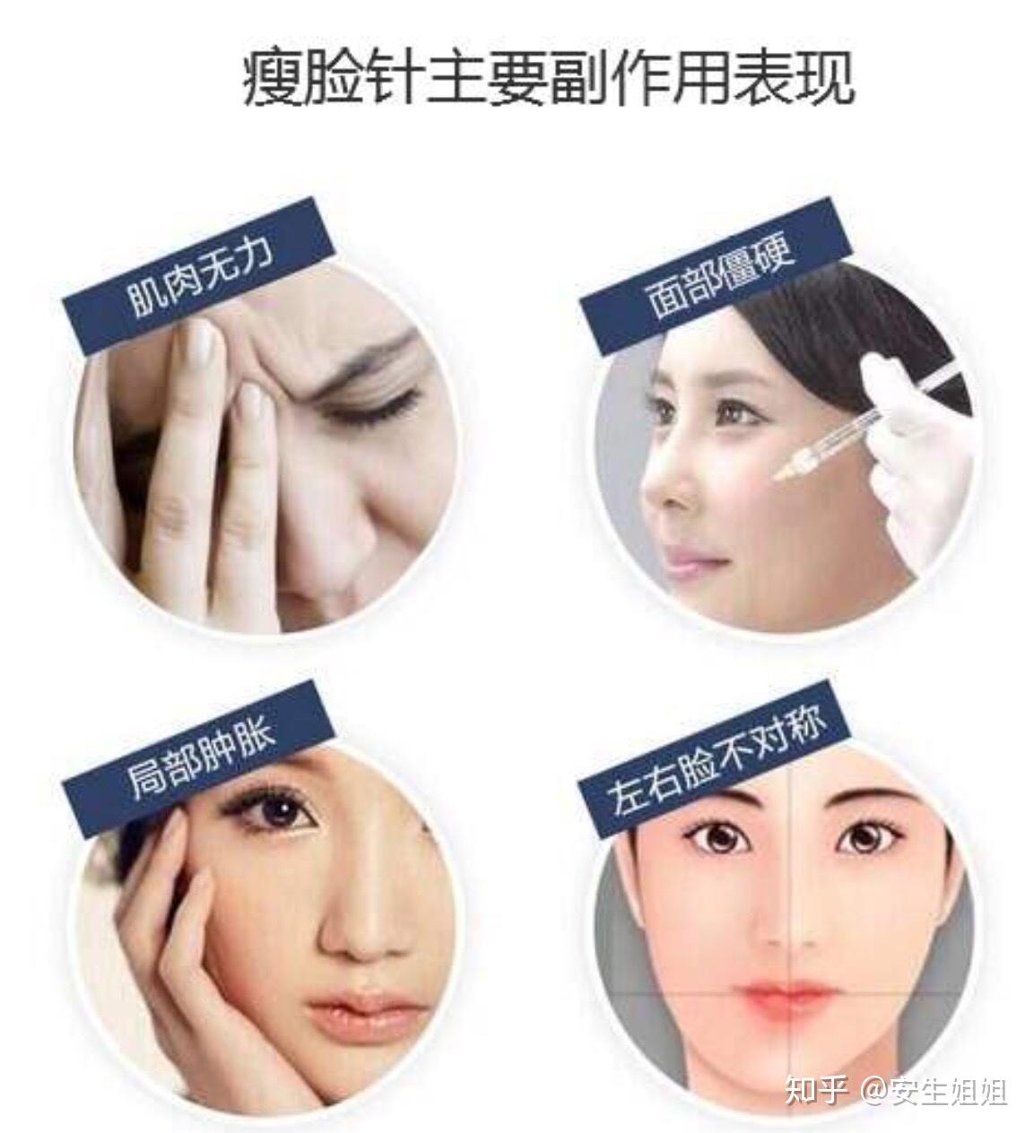 想打瘦脸针可以再等等