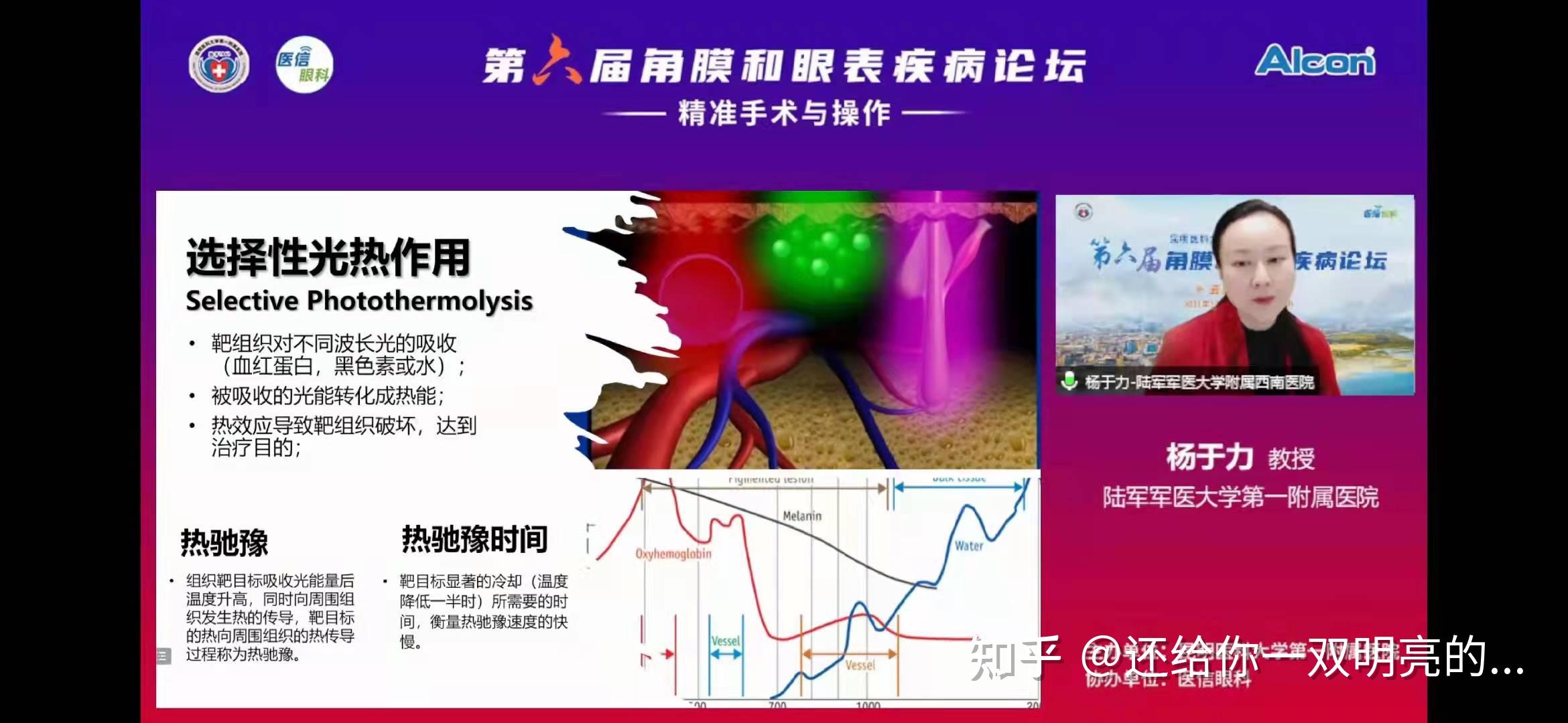 专家讲解强脉冲光（ipl）治疗干眼的临床应用 知乎