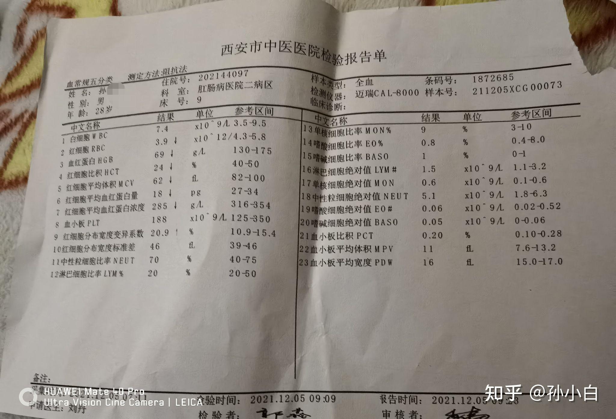 痔疮检查结果单图片图片