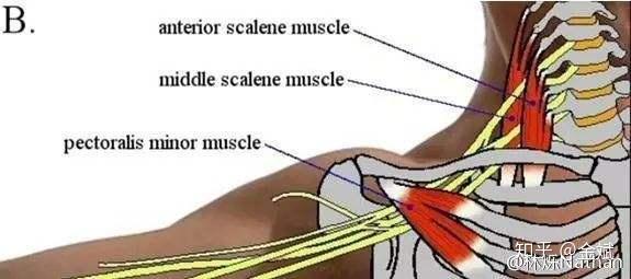 寻寻觅觅,这不是你要的出口