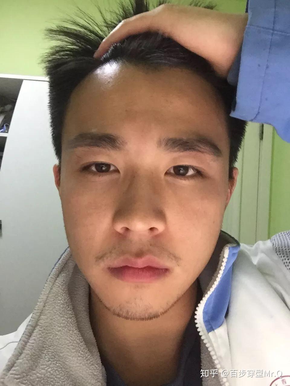 发际线很高的男人适合什么样的发型? - 知乎