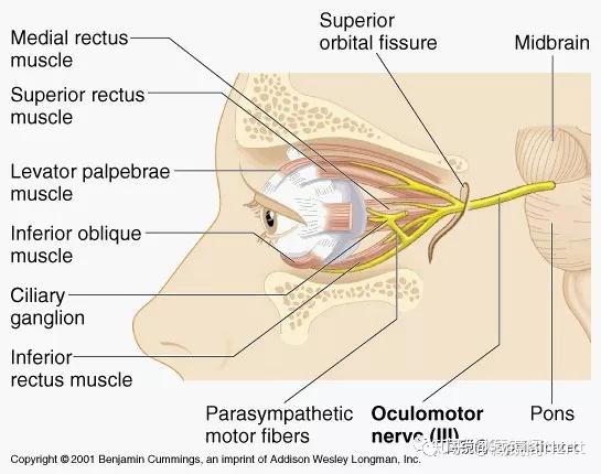 滑车神经外转内旋下转上斜肌(obliquus superior)动眼神经外转外旋上