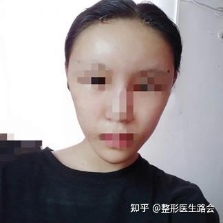 v2-6353b9776b9778b217f1c734cb6654c2_b.jpg